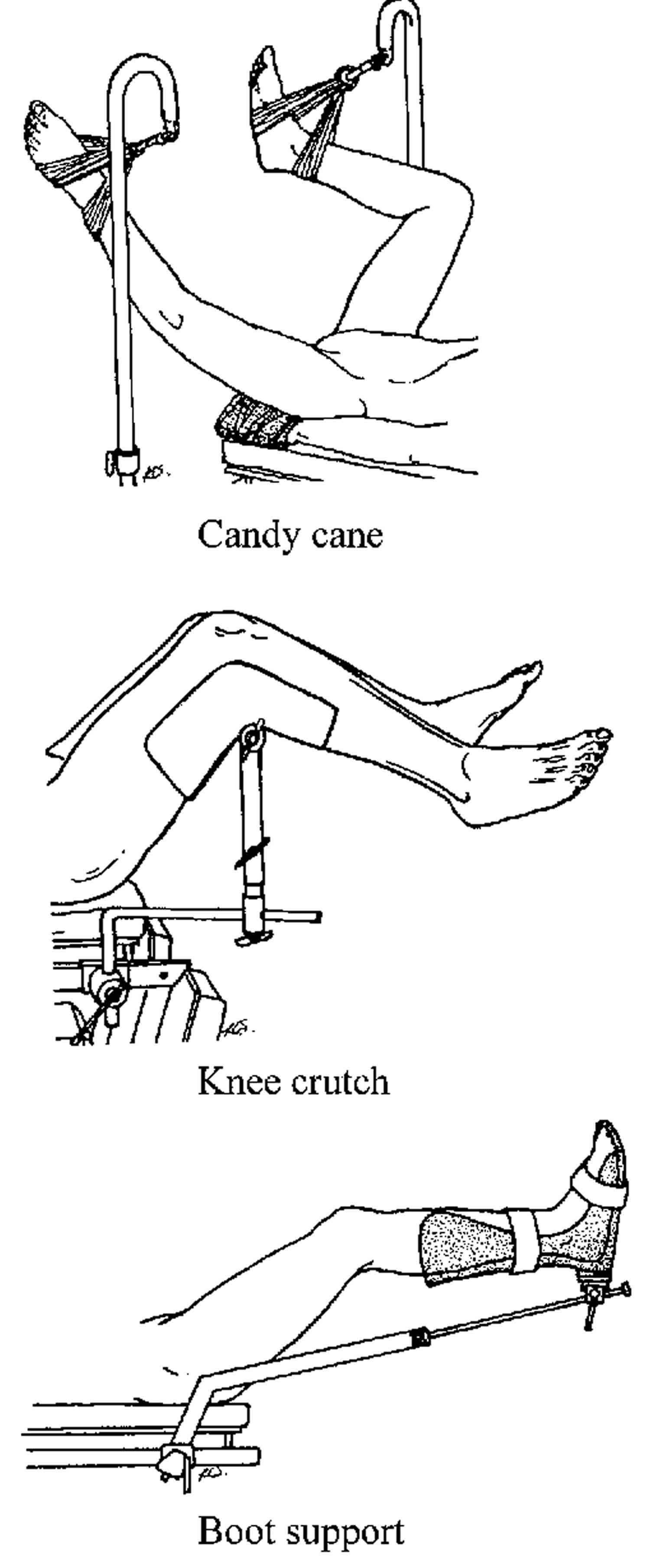 Lithotomy position uses, types, lithotomy position complications