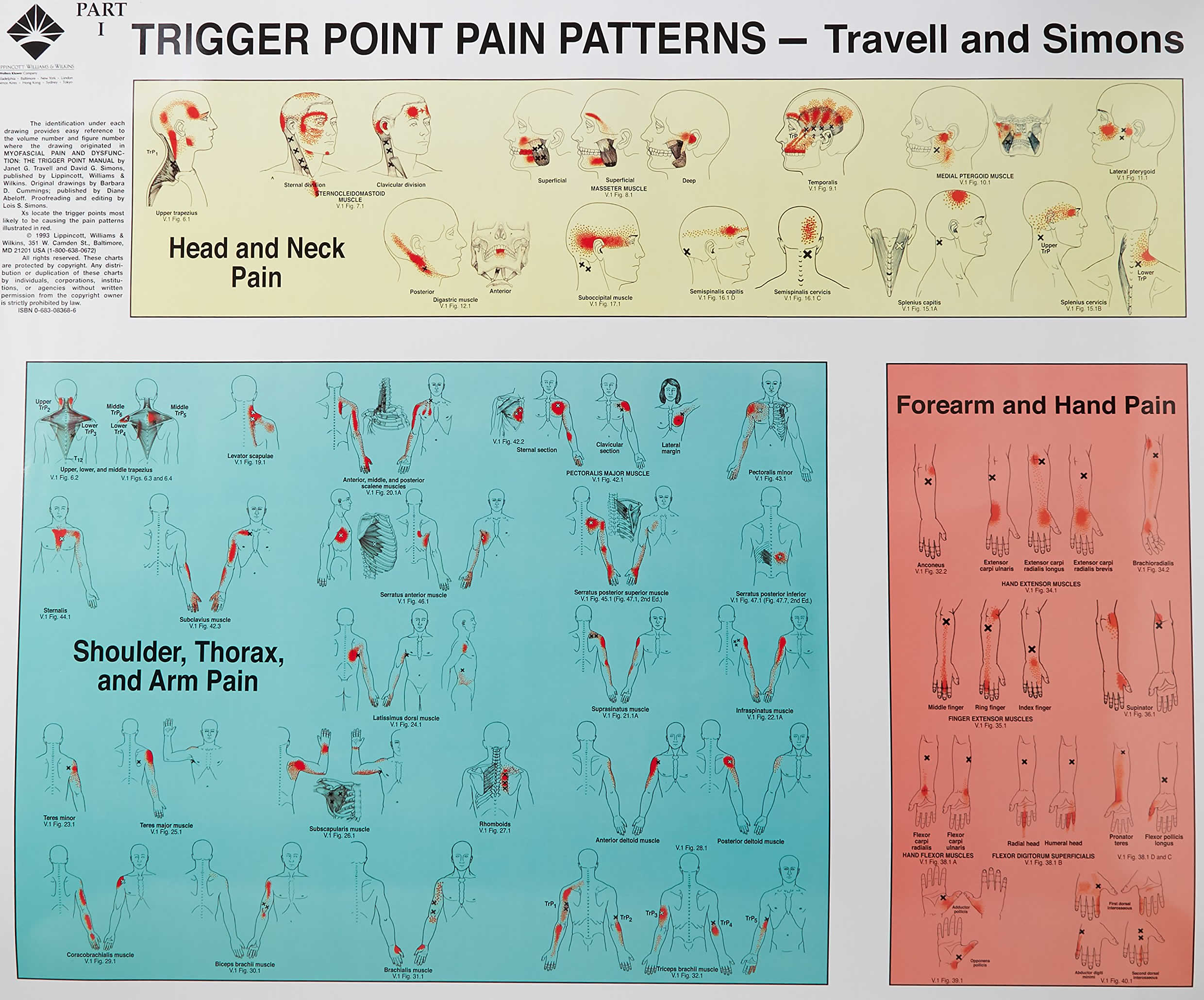 myofascial-pain-syndrome-causes-symptoms-diagnosis-treatment-prognosis