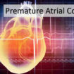 premature atrial contraction