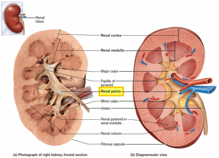 Renal Pelvis Anatomy Function Blockage Cancer Stone