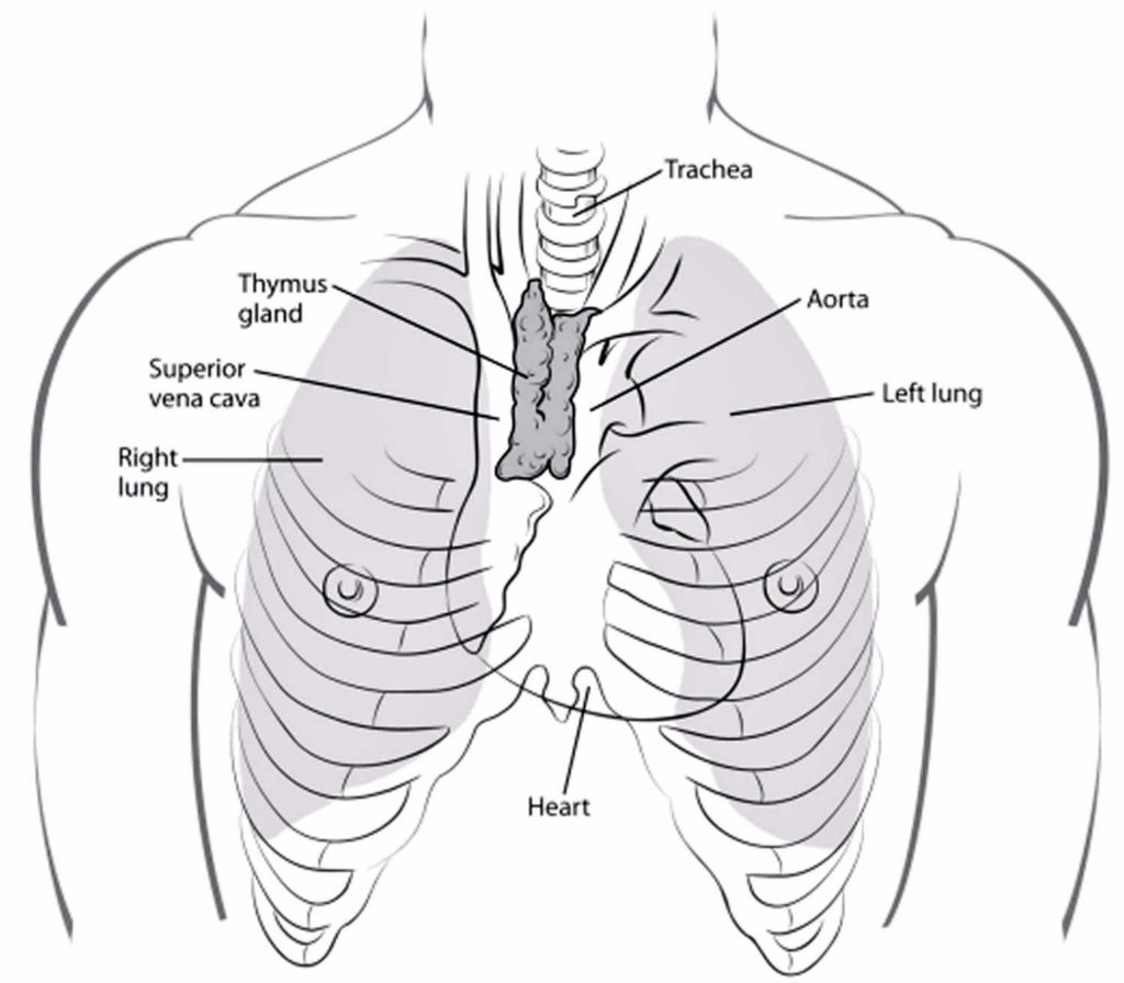 Thymoma cancer, symptoms, diagnosis, treatment & thymoma prognosis