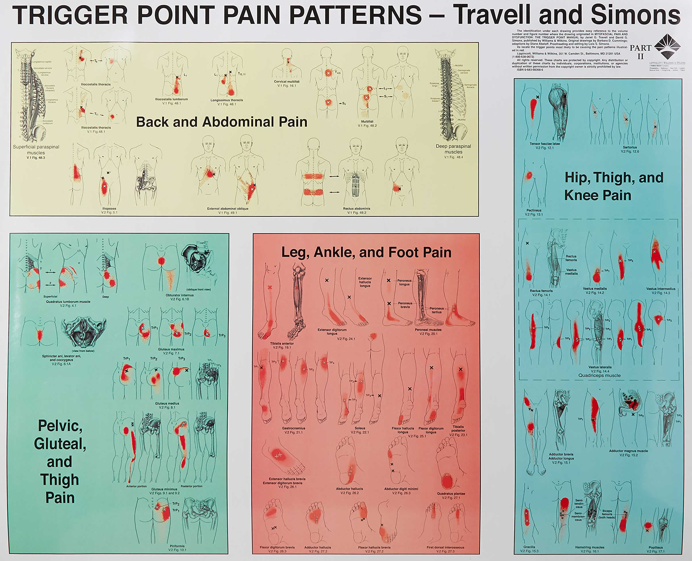 Myofascial trigger points definition, signs, symptoms, diagnosis & therapy