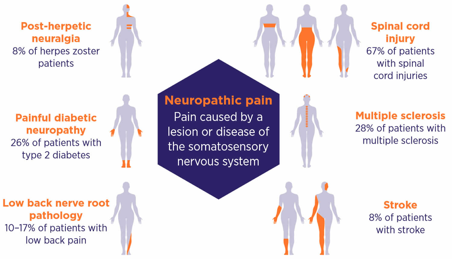 Nociceptive Vs Neuropathic Chart