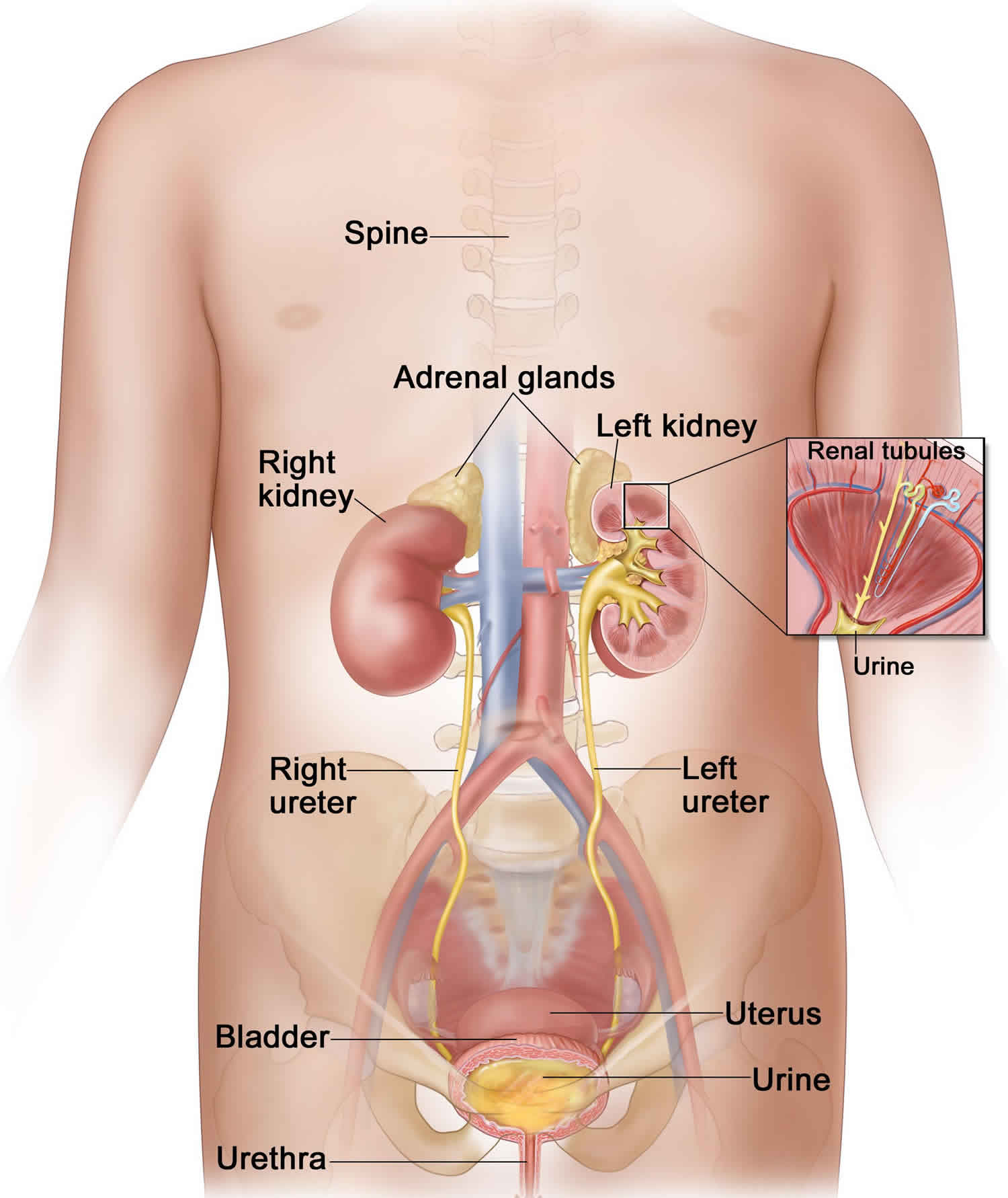 Pyelonephritis Causes Symptoms Complications Diagnosis And Treatment 6784