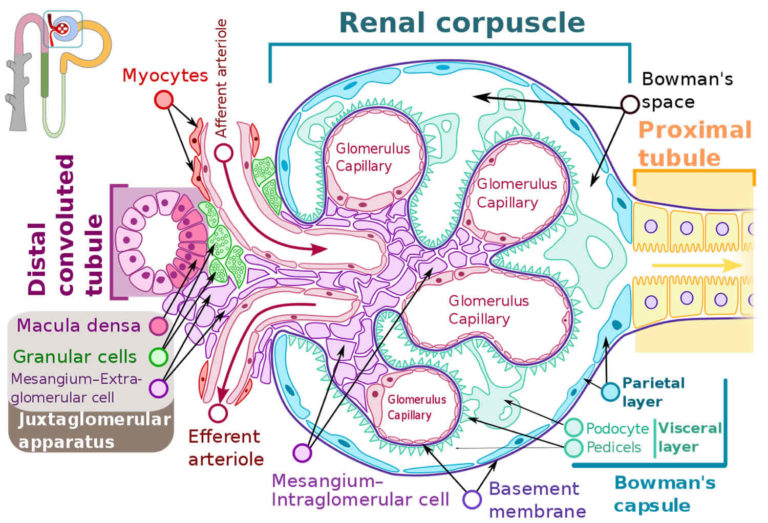 Focal Segmental Glomerulosclerosis Causes, Symptoms, Diagnosis & Treatment