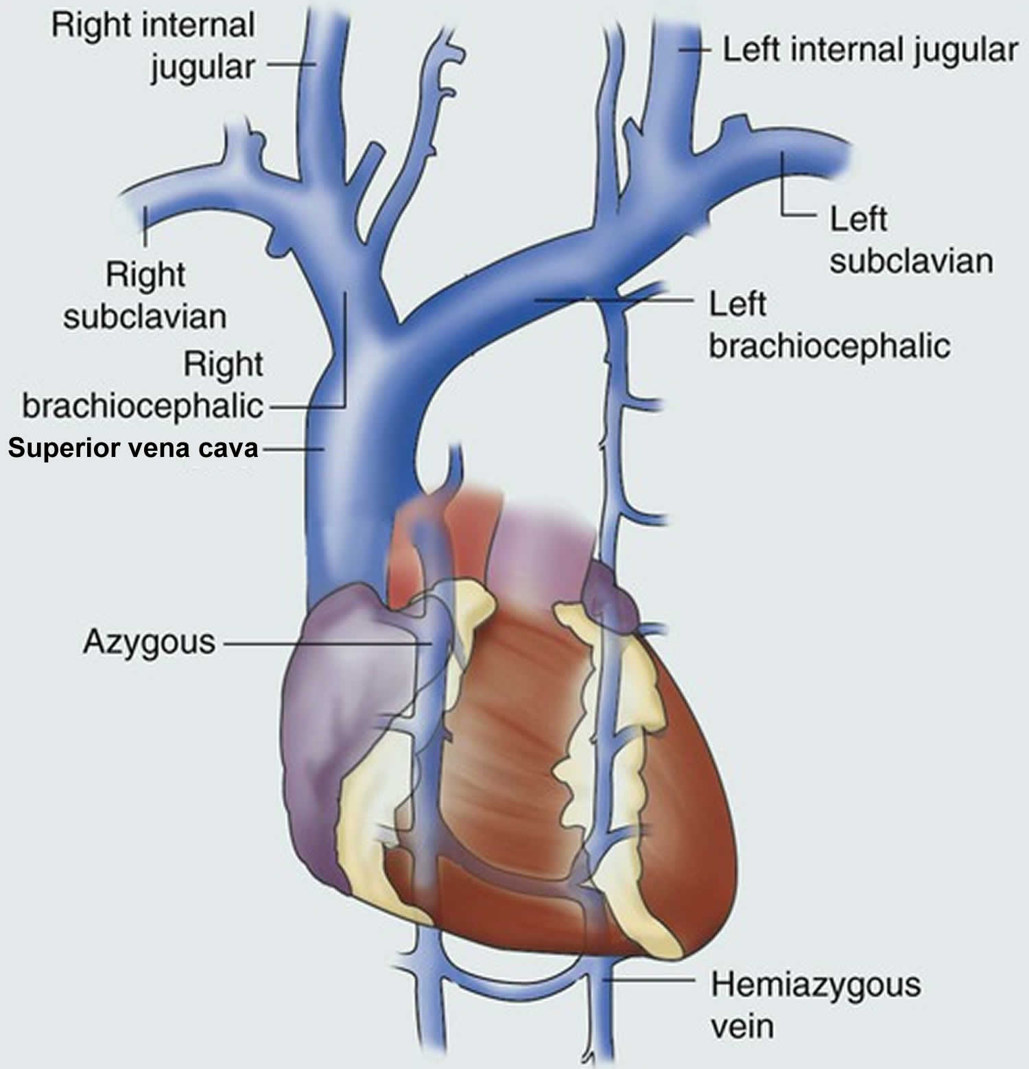  Superior Vena Cava Syndrome SVC Syndrome 