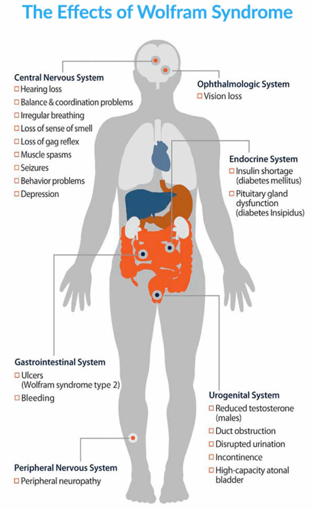 Wolfram syndrome causes, types, symptoms, treatment & prognosis