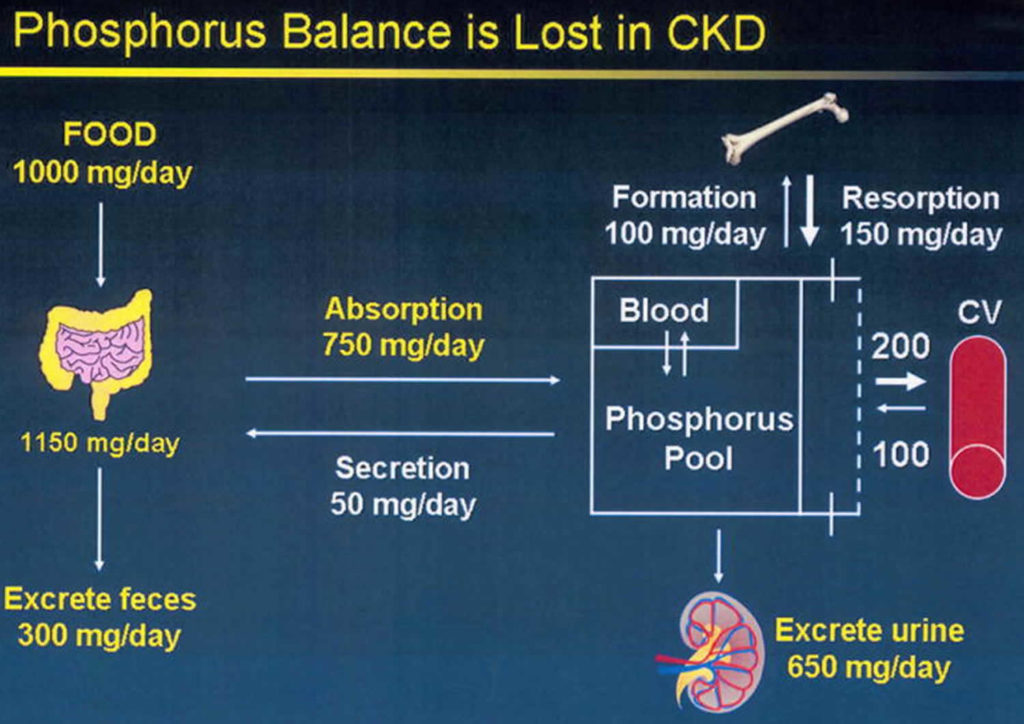 Hyperphosphatemia causes, signs, symptoms, complications & treatment