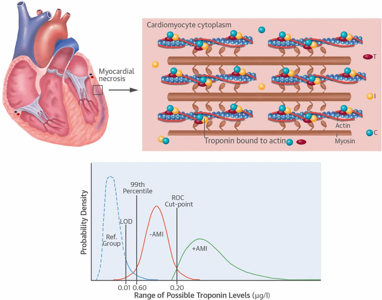 Troponin Test Normal Troponin Levels Causes Of Elevated Troponin Levels