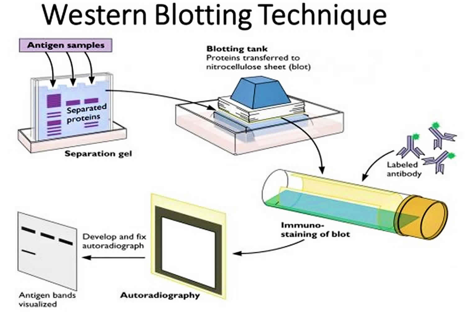 What is the purpose of the Western blot test?