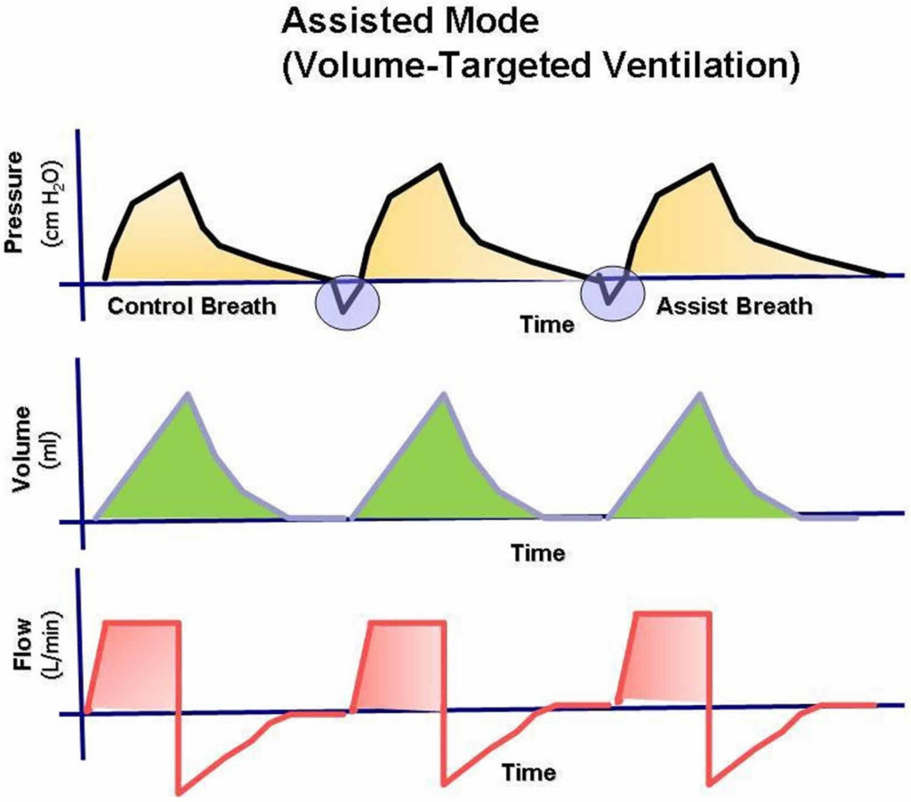 Mechanical Ventilation Types, Indications, Complications, Settings & Modes