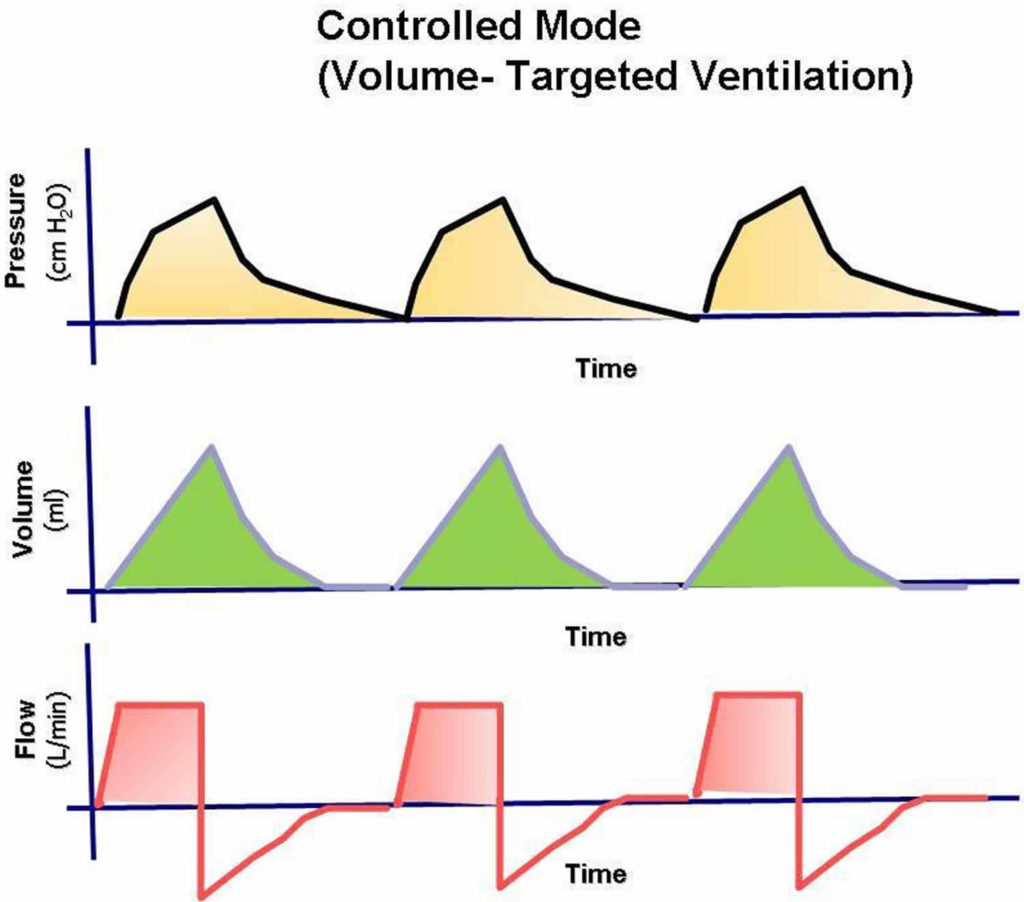 Mechanical Ventilation Types, Indications, Complications, Settings & Modes