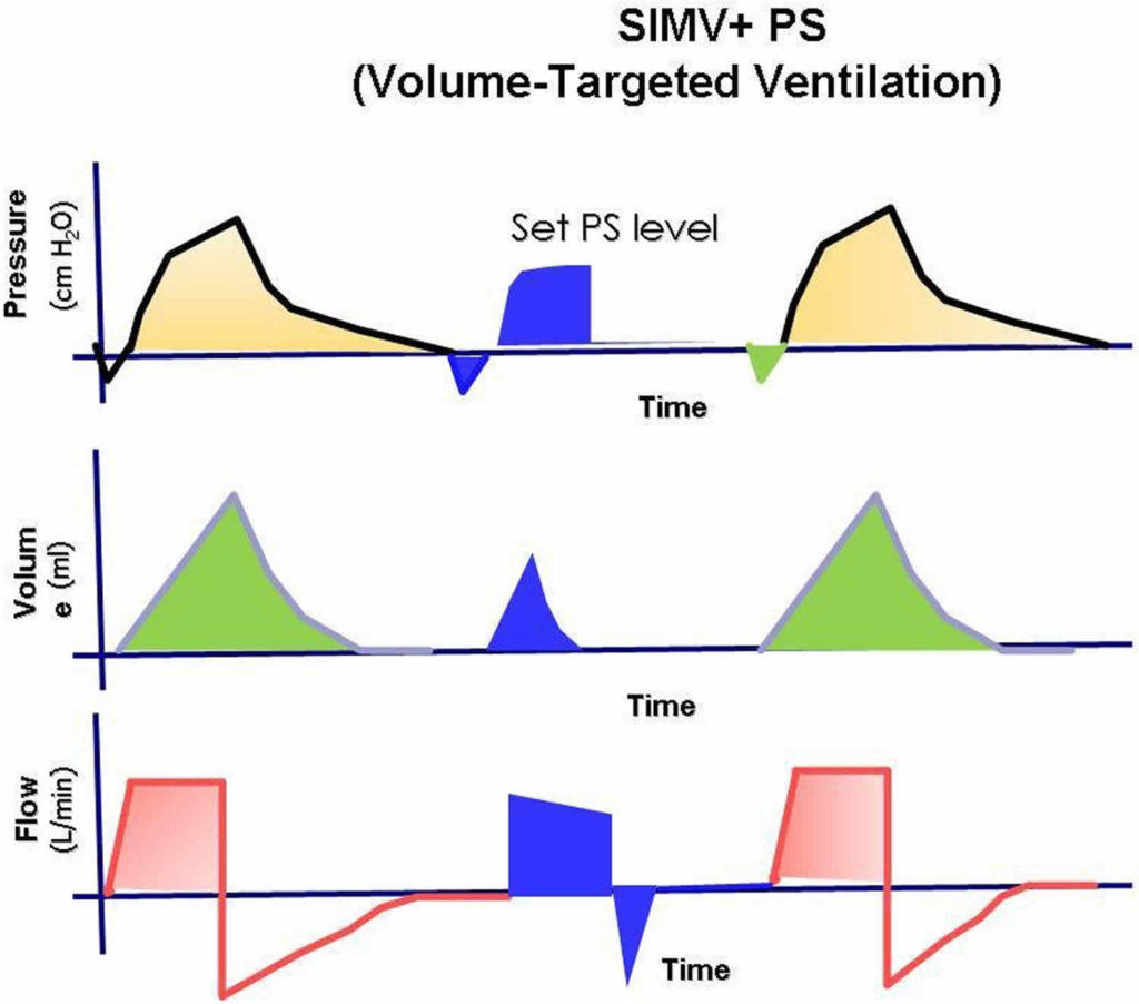 Mechanical ventilation types, indications, complications, settings & modes