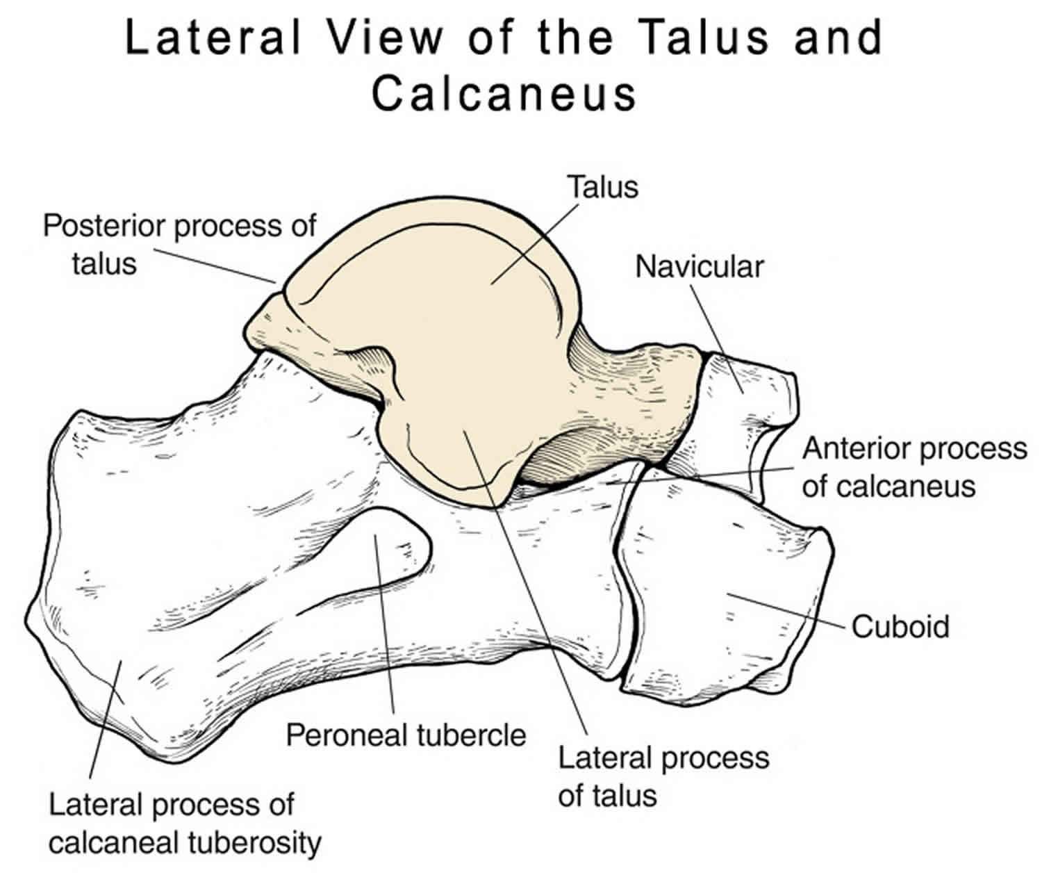 Fracture talus Stress Fracture