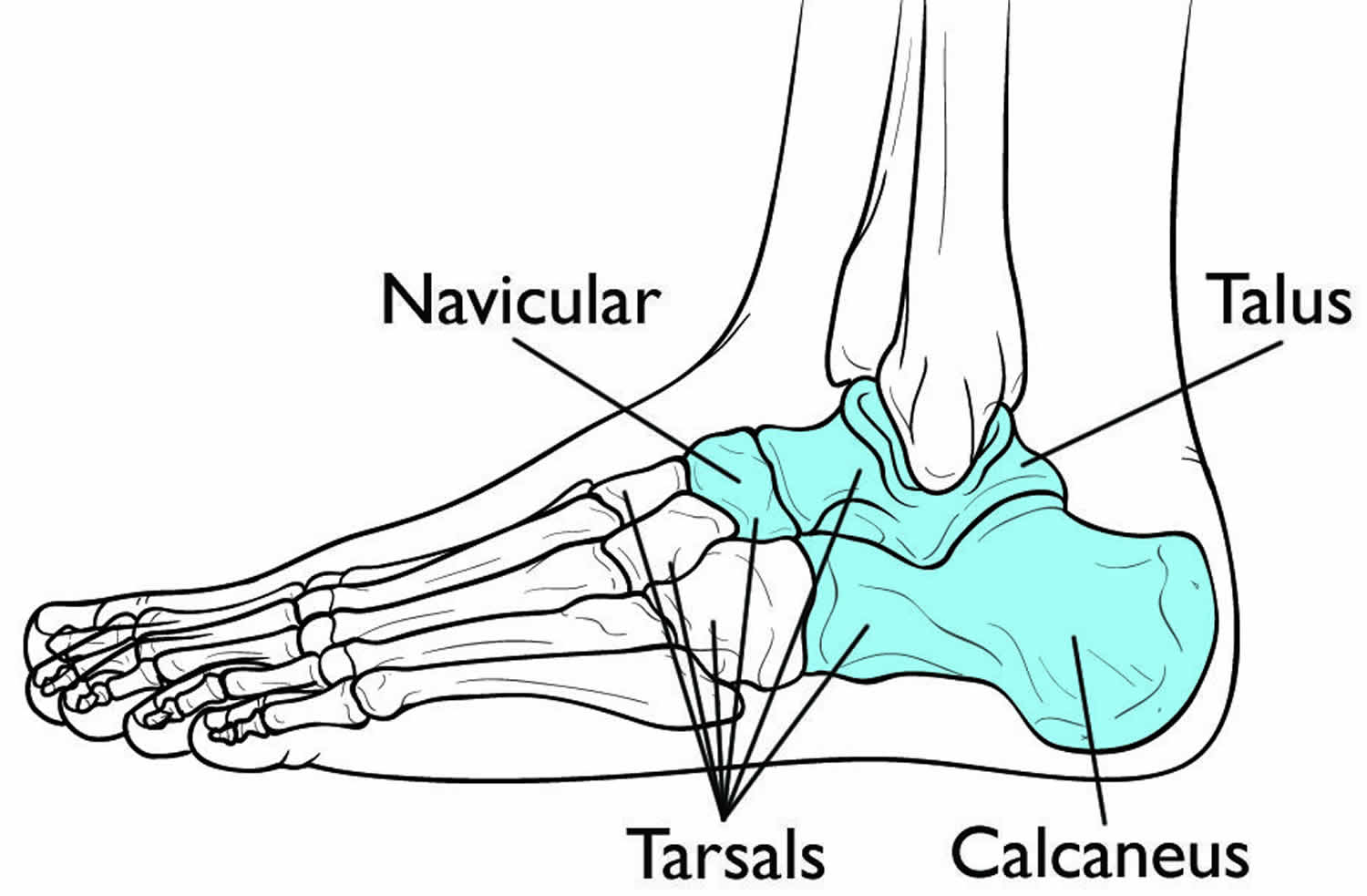 Tarsal Coalition Causes Symptoms Diagnosis And Treatment