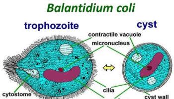 Balantidiasis