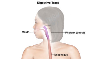 Eosinophilic gastroenteritis