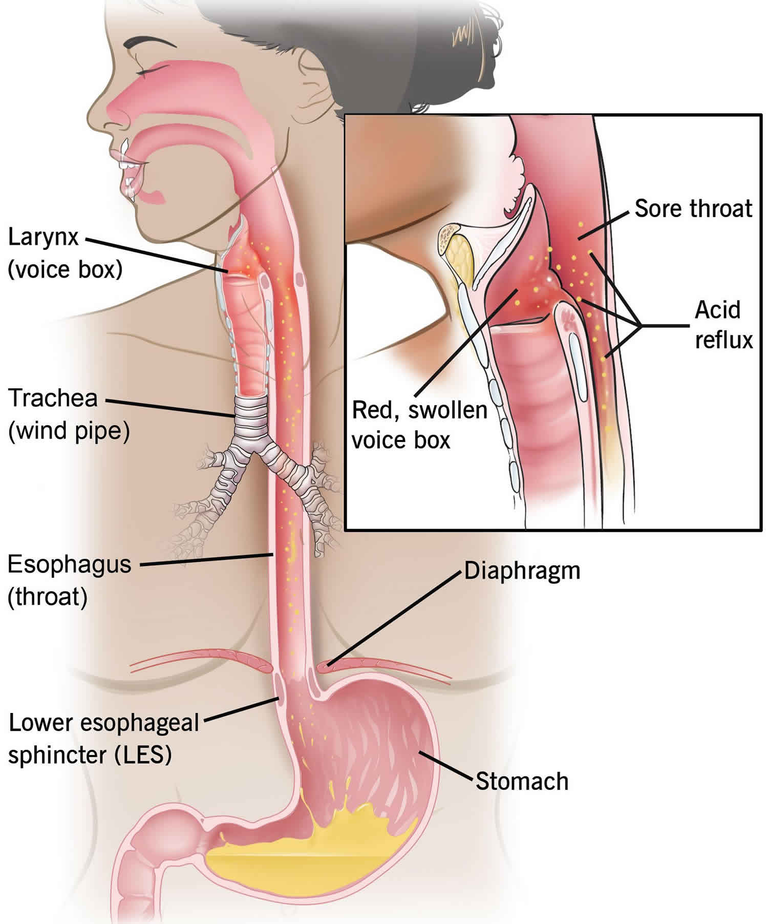 windpipe-esophagus-diagram