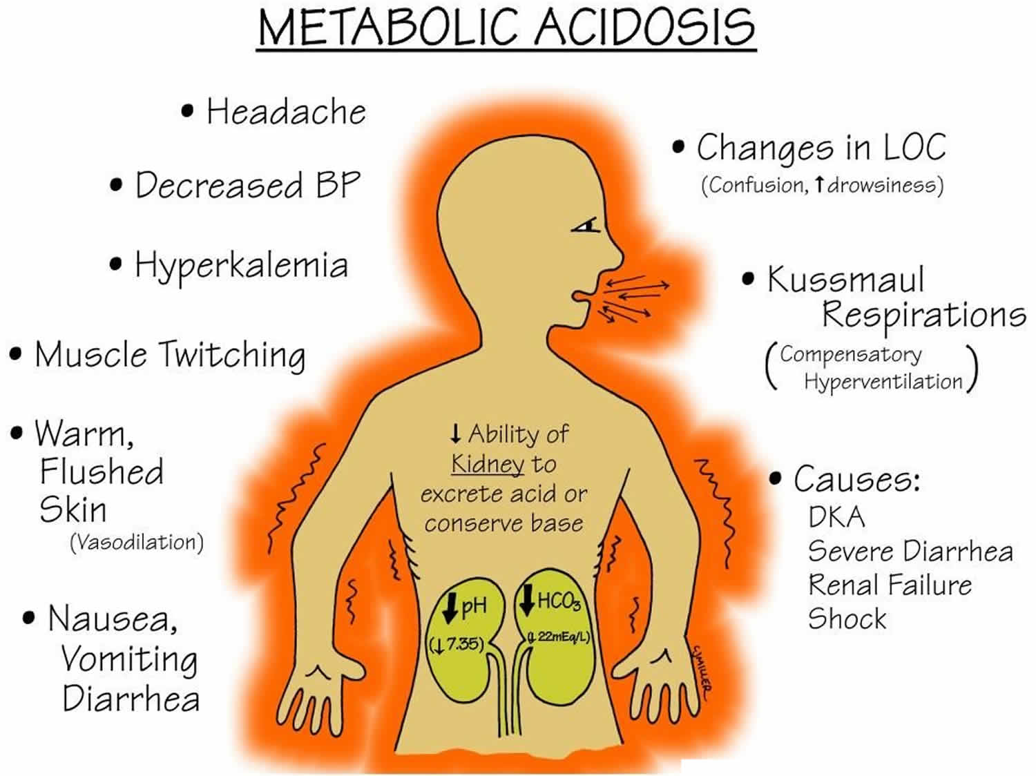 Hyperchloremic acidosis definition, causes, symptoms, diagnosis & treatment