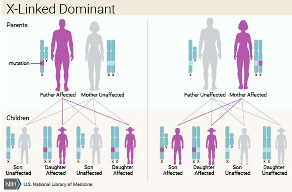 Incontinentia pigmenti causes, symptoms, diagnosis, treatment & prognosis