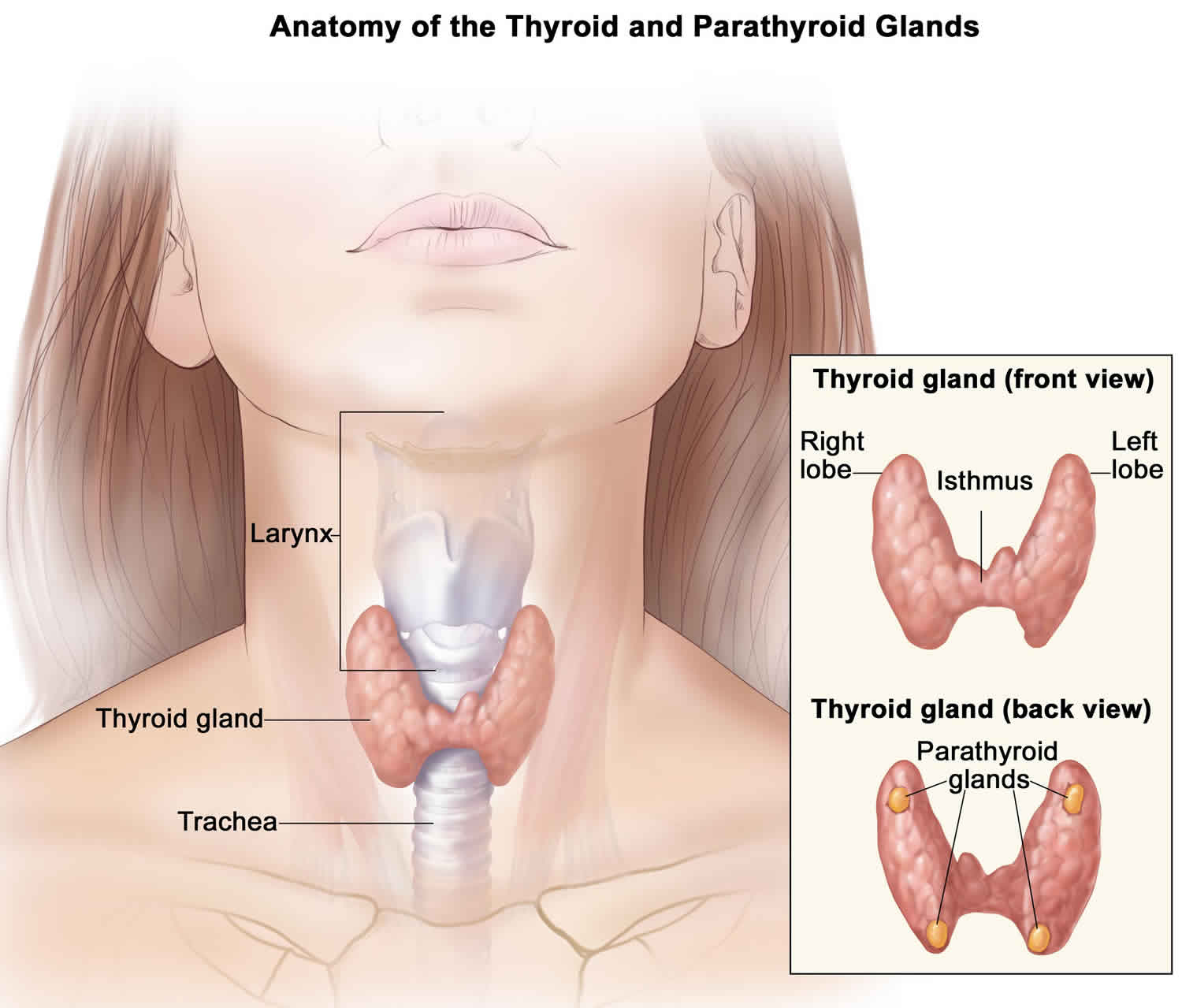 papillary carcinoma