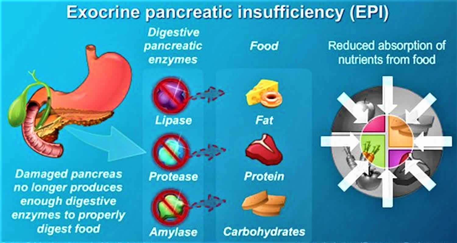 Exocrine Pancreatic Insufficiency 