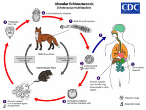 Hydatid cyst causes, symptoms, diagnosis, treatment & prognosis