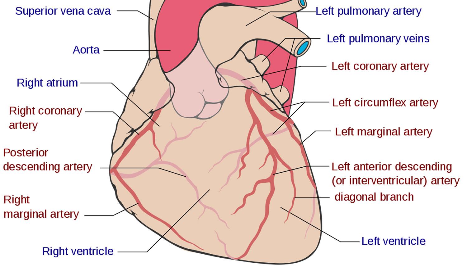 Anomalous Coronary Artery Types Symptoms Diagnosis Treatment