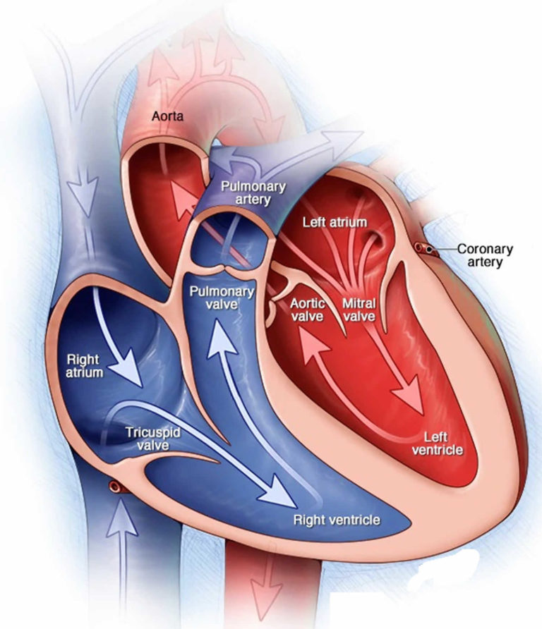 aortic-stenosis