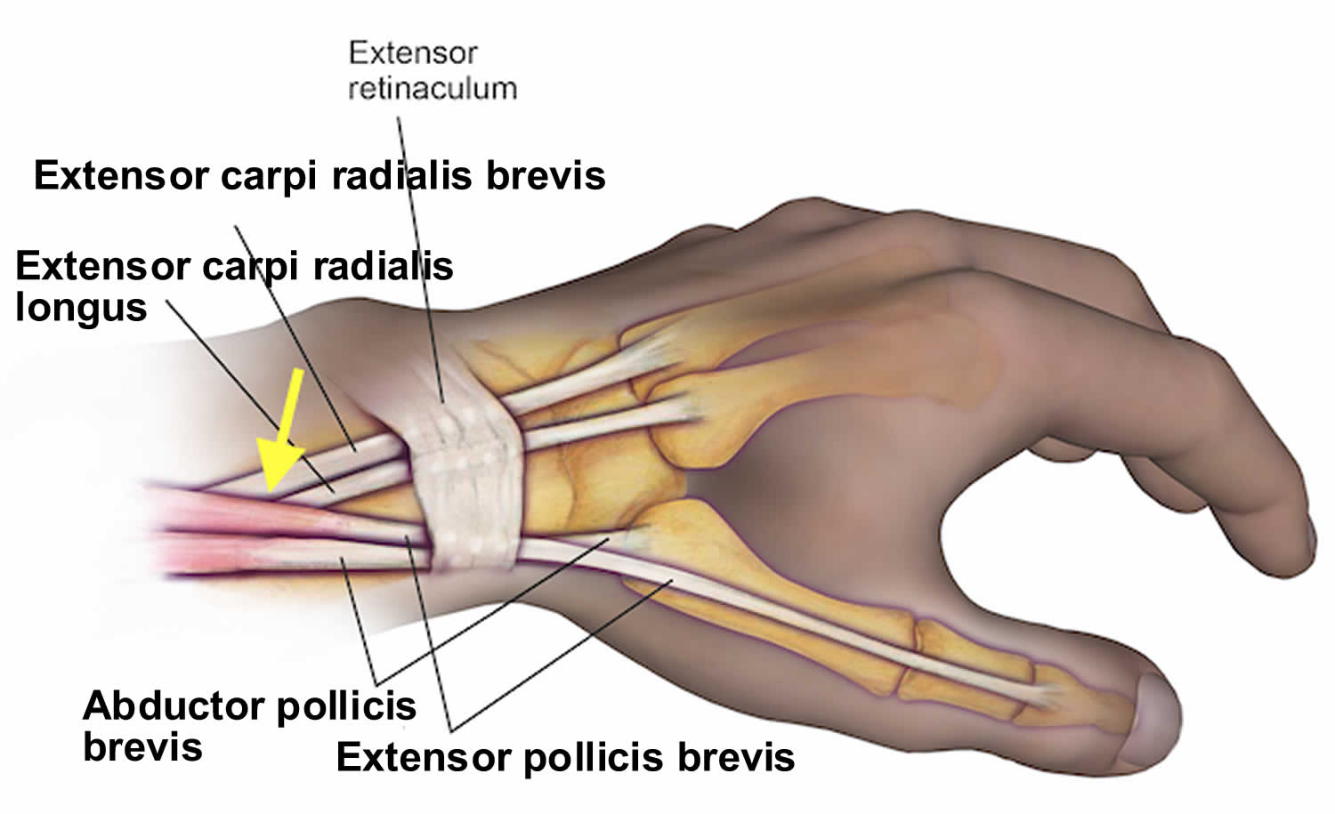 intersection syndrome symptoms