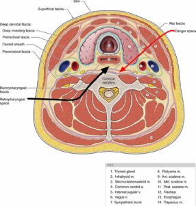 Retropharyngeal abscess causes, symptoms, diagnosis, treatment & prognosis