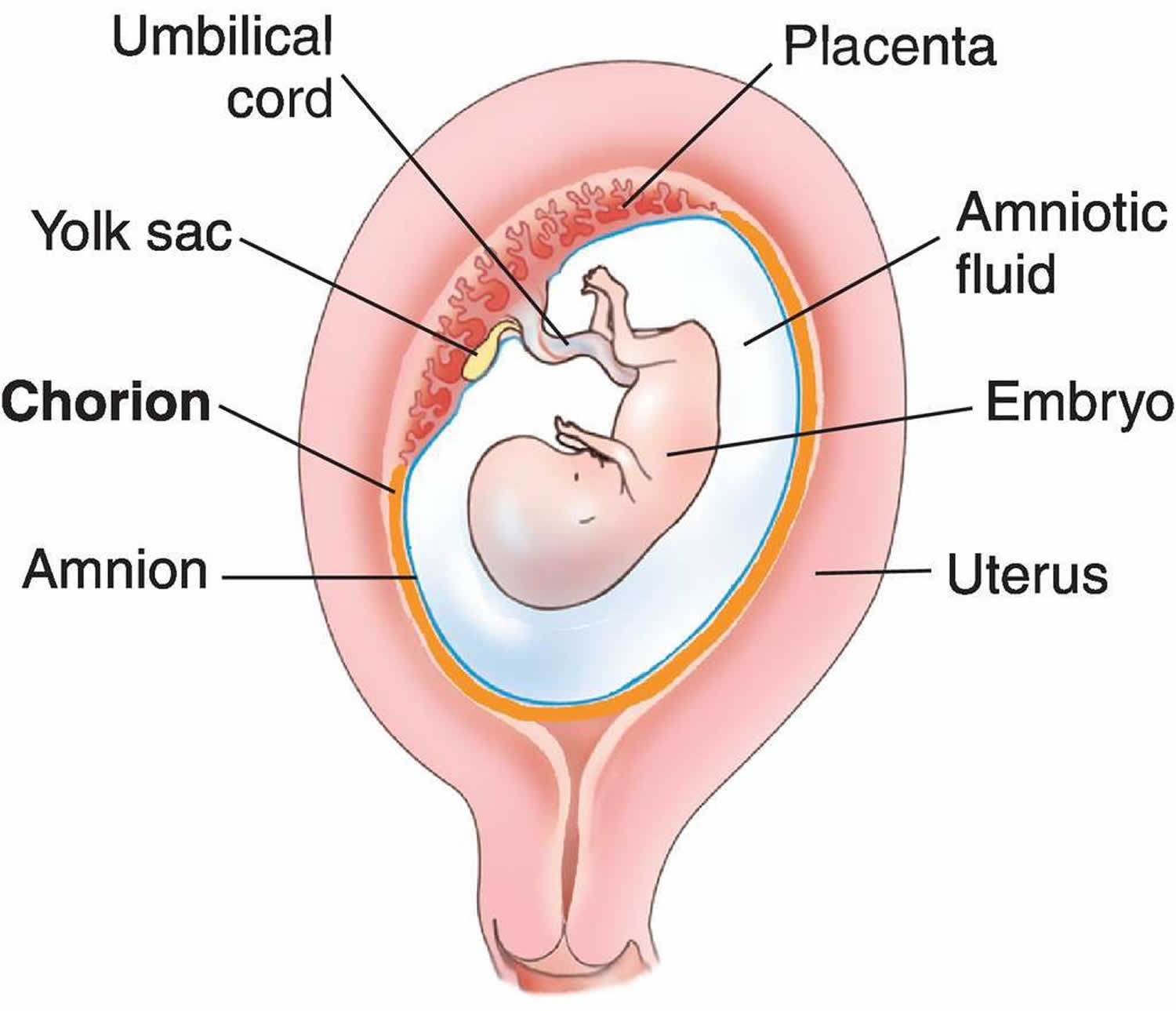 Chorioamnionitis Definition Causes Symptoms Diagnosis Treatment