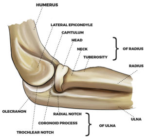 Olecranon fracture causes, symptoms, diagnosis, treatment & prognosis