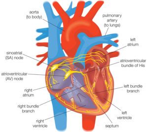 Ventricular fibrillation causes, symptoms, diagnosis, treatment & prognosis