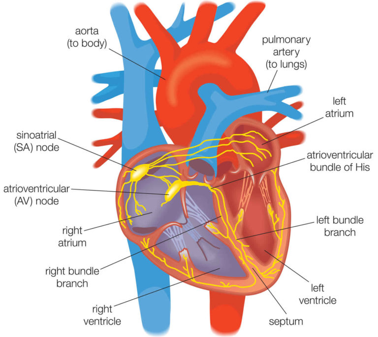 Ventricular Fibrillation Causes, Symptoms, Diagnosis, Treatment & Prognosis