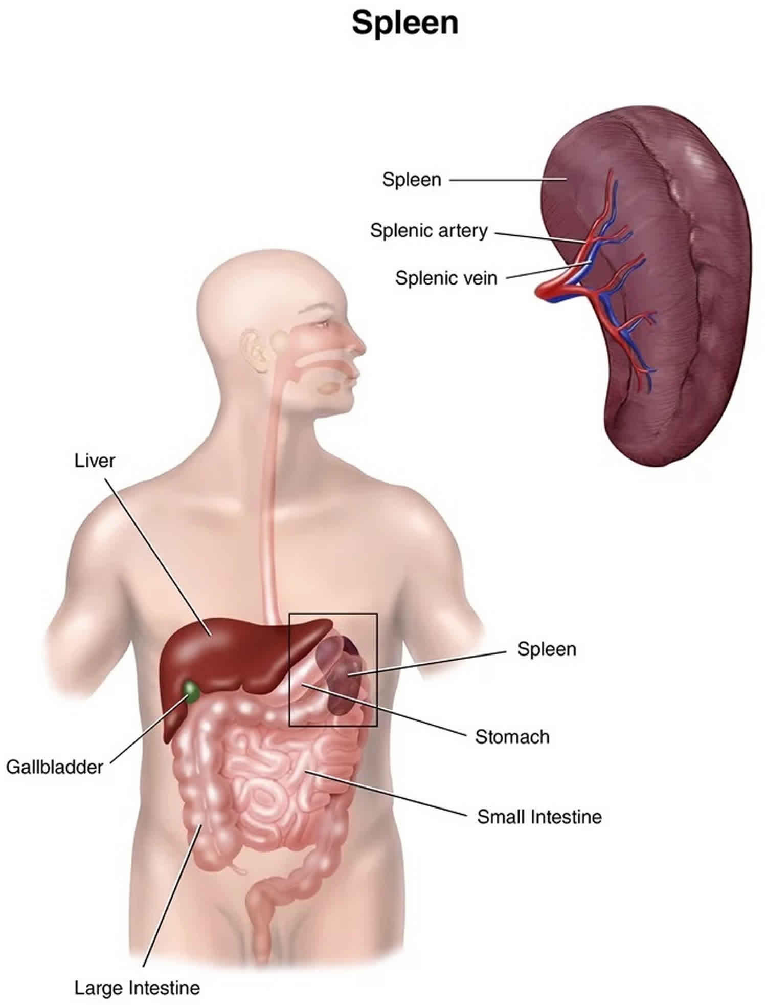 Splenic Infarction Causes Symptoms Diagnosis Treatment Prognosis