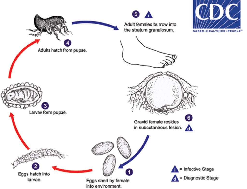 Tungiasis Causes, Symptoms, Diagnosis, Treatment & Prognosis