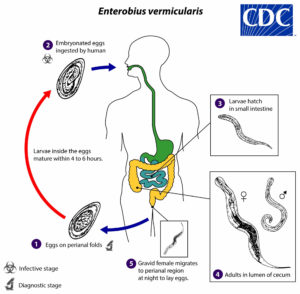 Enterobiasis Causes, Symptoms, Diagnosis & Treatment