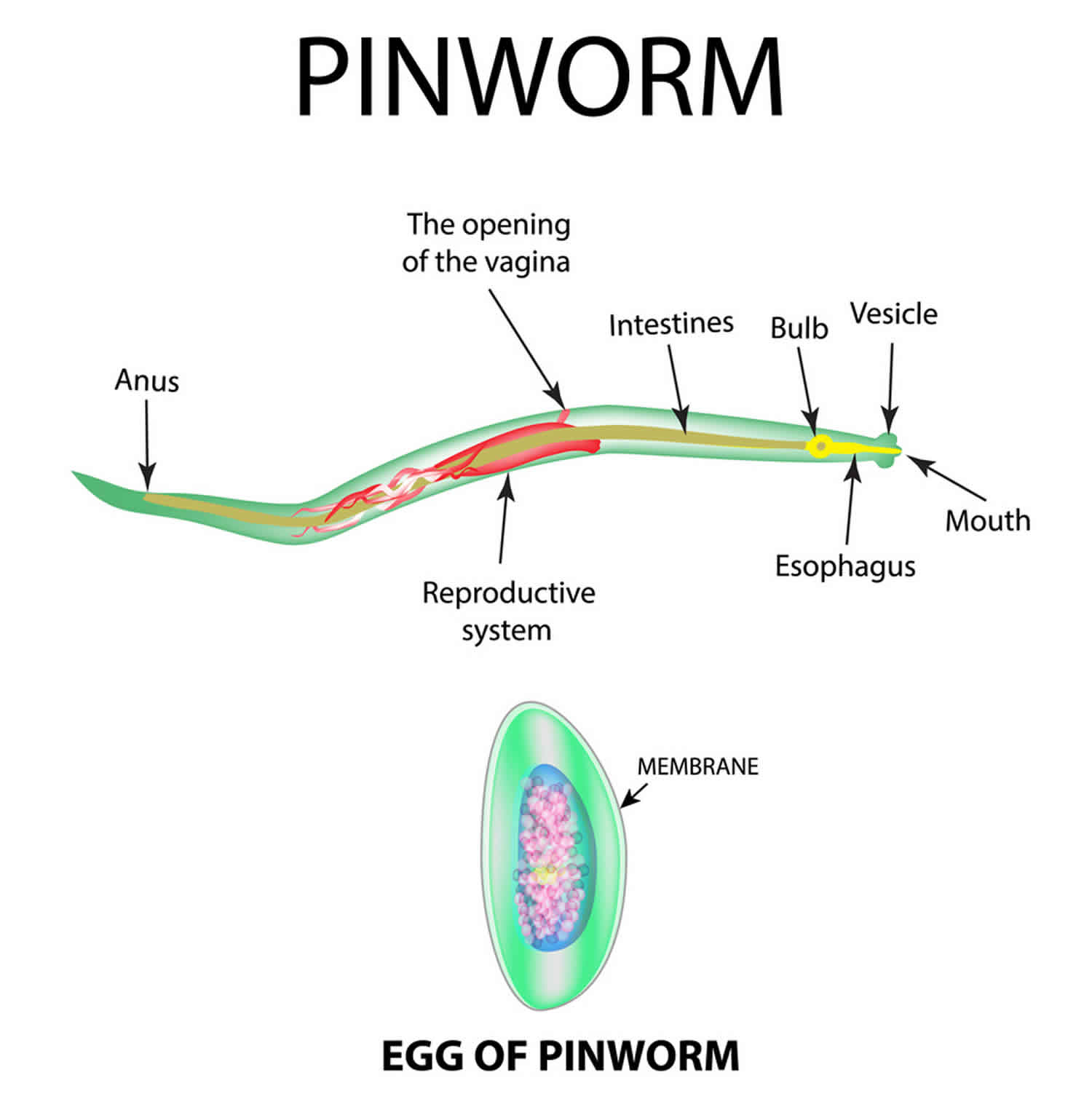 A pinworms enterobiosis