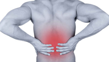 Lumbosacral radiculopathy