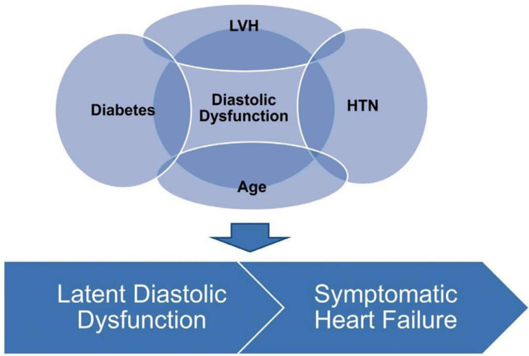 Diastolic dysfunction definition, causes, symptoms, diagnosis & treatment