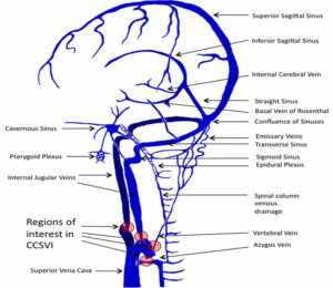 Cerebral circulation, cerebral circulation anatomy, venous circulation ...