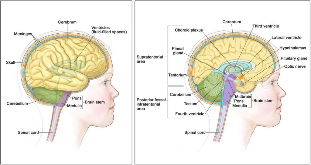 ATRT cancer, causes, symptoms, diagnosis, treatment & survival rate