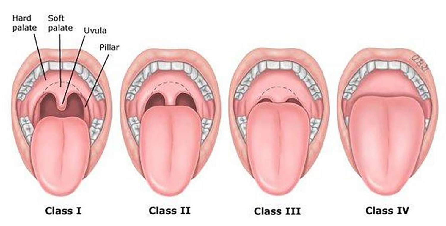 Bite Classifications – ClearCorrect Support