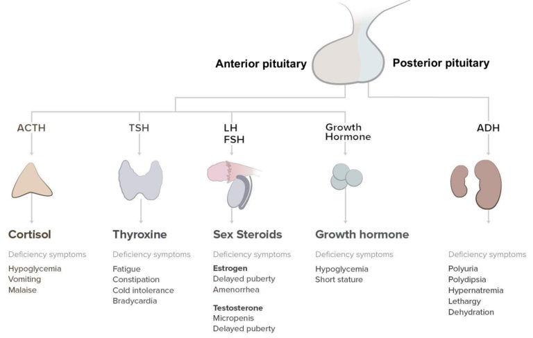 Panhypopituitarism causes, symptoms, diagnosis & treatment