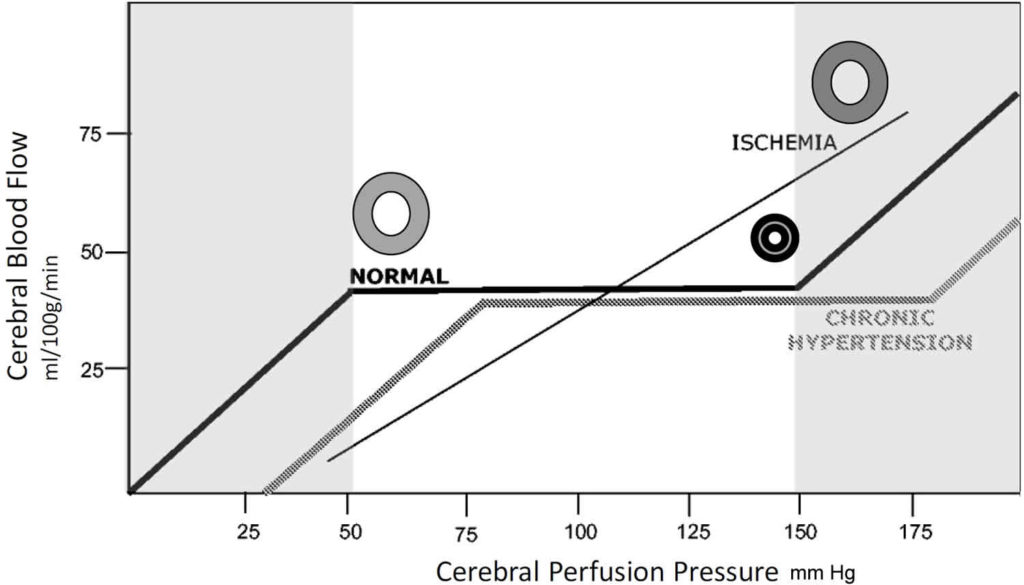 Cerebral Perfusion Pressure Cerebral Perfusion Pressure Equation