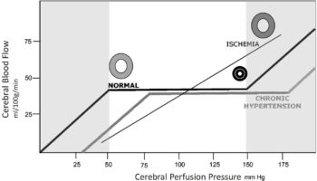 Cerebral perfusion pressure