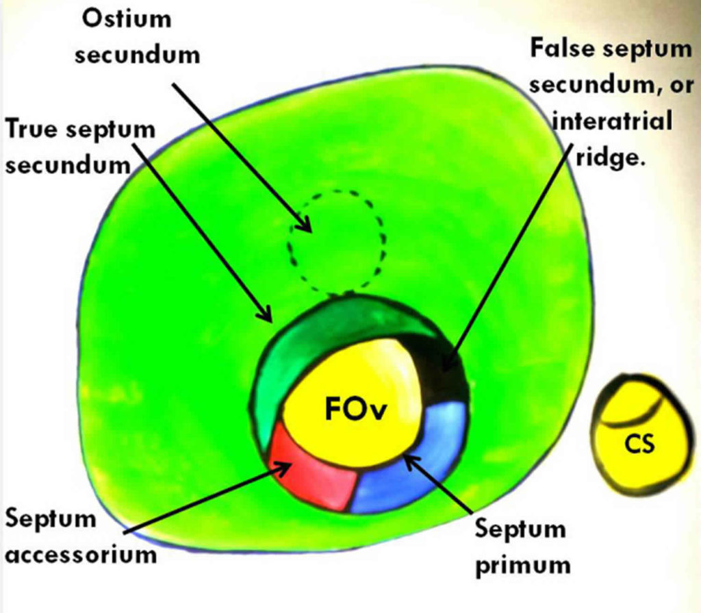 Fossa ovalis and fossa ovalis function