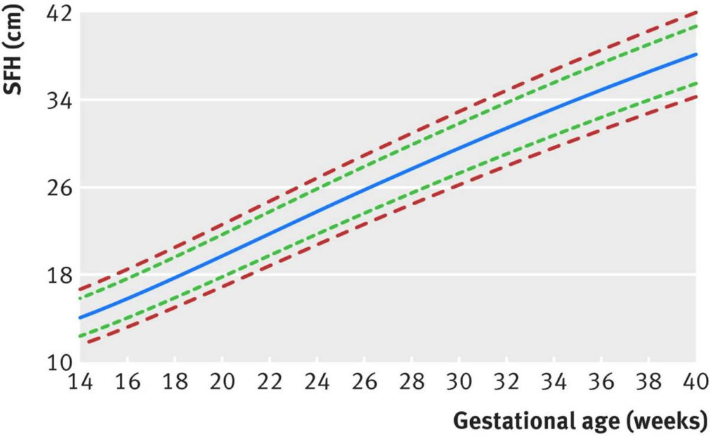 Understanding Your Fundal Height: A Key Pregnancy Measurement