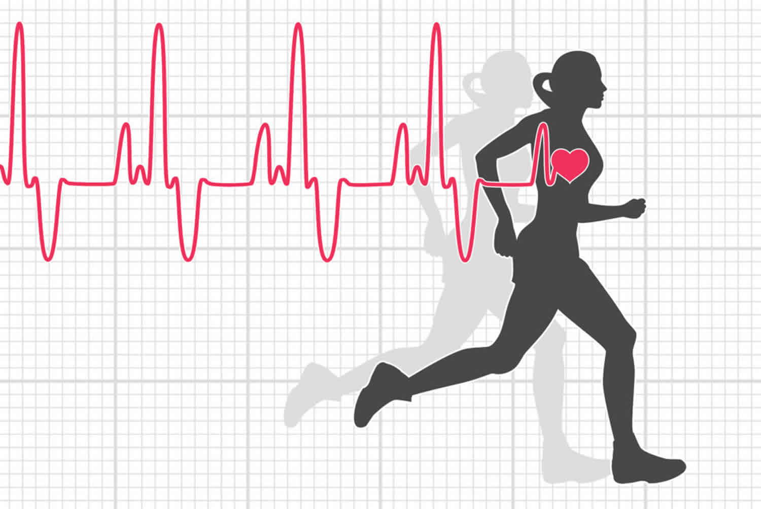 Heart Rate Recovery After Exercise Definition As Predictor Of Mortality